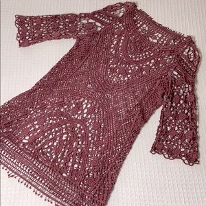 Lacey mid length dress overlay